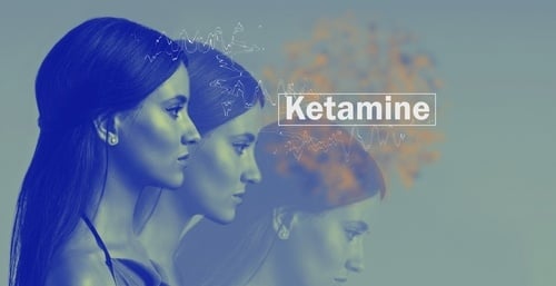 Ketamine for Depression: What You Need to Know